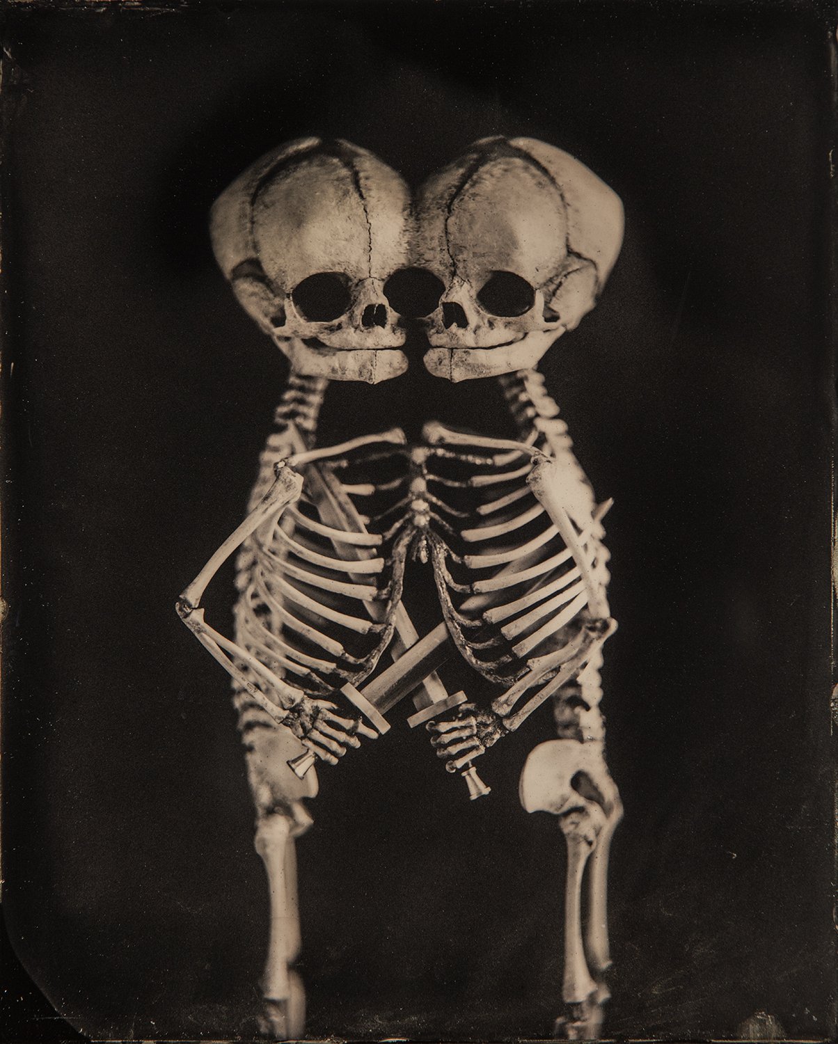 fetal skeleton — News — PAUL NITSCHE